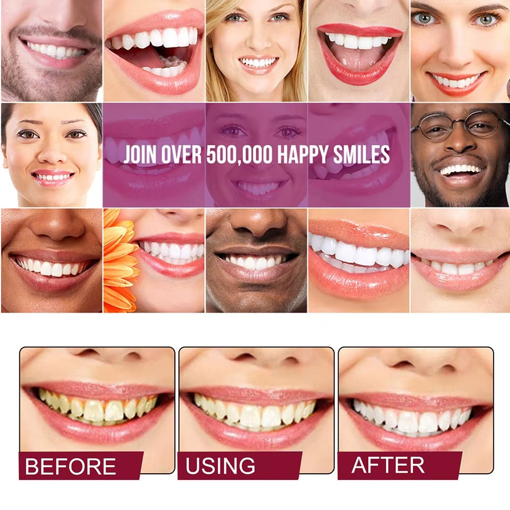 Whitening Toothpaste Sp4 Ultra Whitening Teeth Plaque Remover